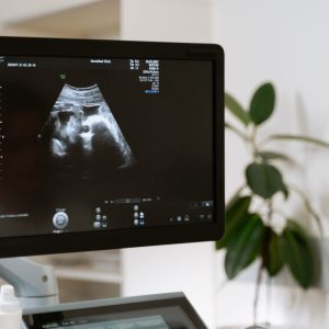 Vilo corial tem diagnóstico genético precoce