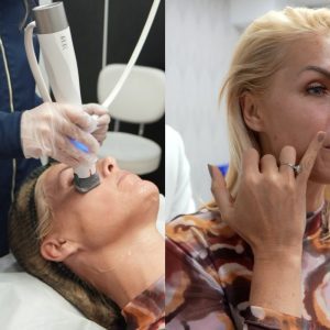 XERF conquista celebridades que buscam a renovação da beleza
