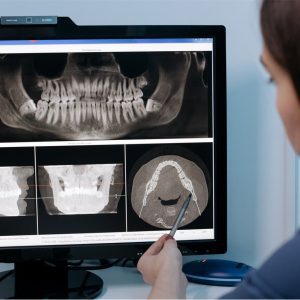 Com baixa penetração no mercado, planos odontológicos carecem de inovação