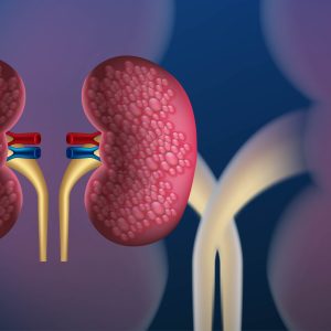 Doença renal crônica subdiagnosticada causa mortes