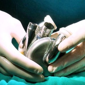 Pesquisadores implantam pela 1ª vez coração totalmente artificial em paciente nos EUA