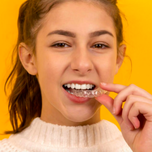 Alinhador invisível: como funciona o tratamento dentário