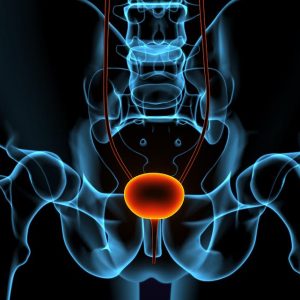 Urologista explica diferenças entre HPB e câncer de próstata