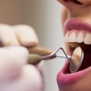 Sangramento na gengiva pede avaliação, alerta dentista