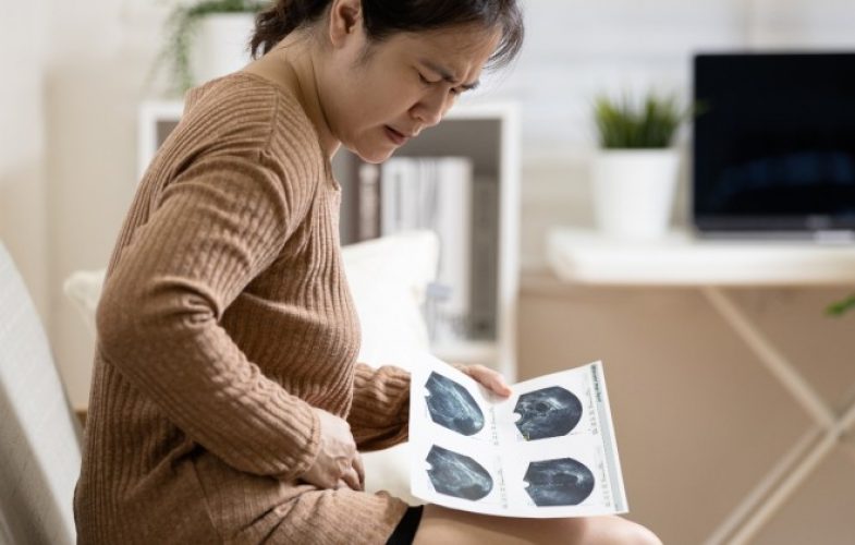 cancer-no-ovario-article-1